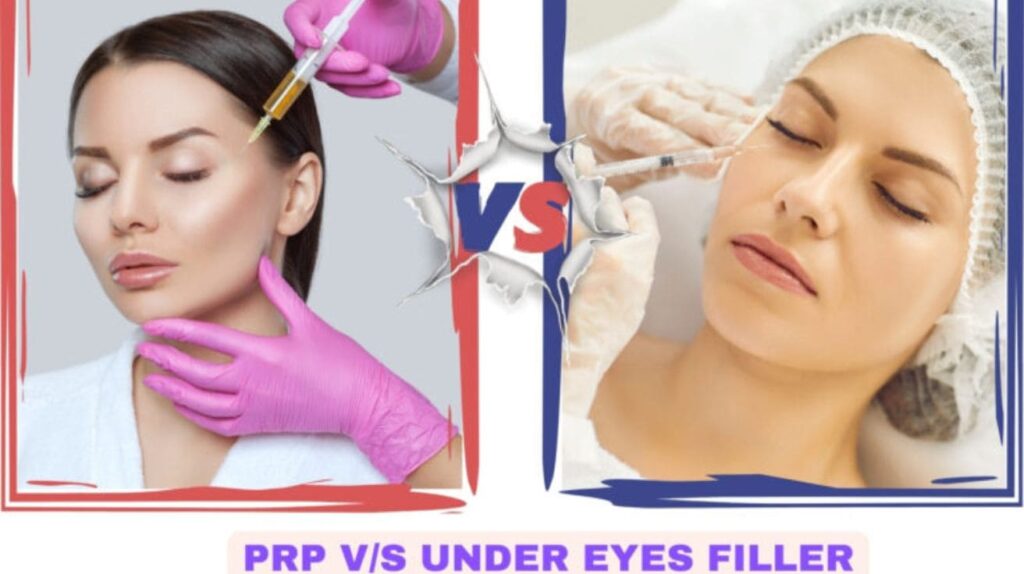 PRP vs under eye filler comparison for treating dark circles, hollows, and tired-looking eyes