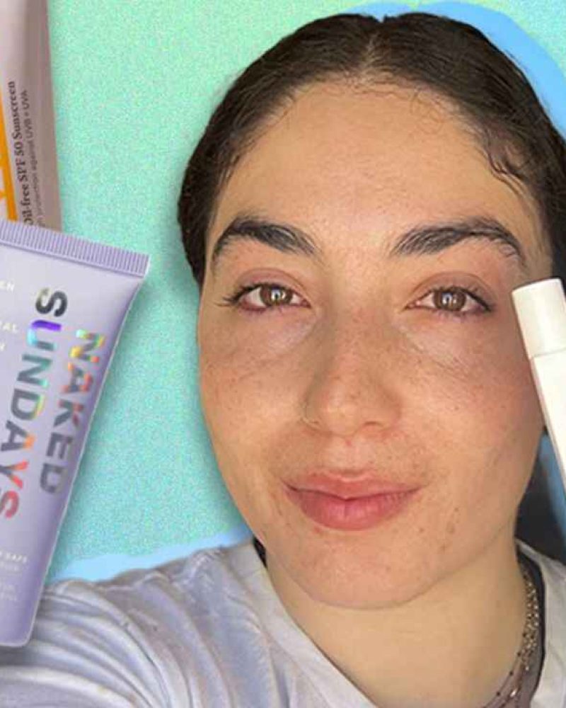select-Acne-suncreens (1)